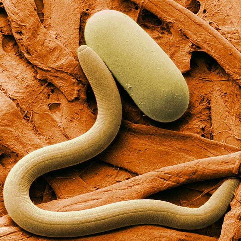 Microscopic view of a worm-like creature on a textured brown surface