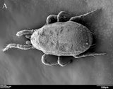 Scanning electron micrograph of a mite on a gray background